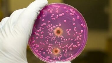 Патологично освобождаване от мъжете, когато се вълнува